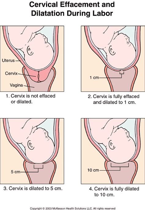 You have to check them for lice. How to Check Your Own Cervix