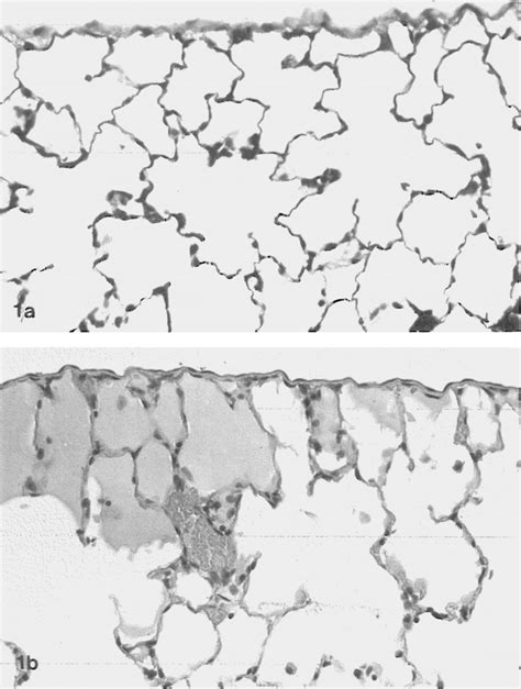 I said pretreat the grass stains of marital discord with the fabric softener of forgiveness. -(a) Section ofperipheral lung from saline pretreated rat ...