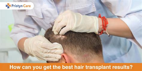 Hair loss and weight gain may occur naturally as you age; How can you get the best hair transplant results ...