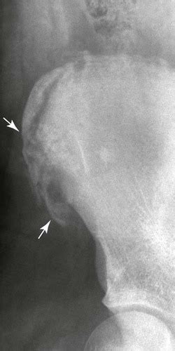 Trauma | Radiology Key