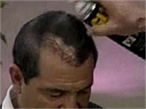 Popeil, who is widely regarded as the … read more on dailymail.co.uk. GLH Formula | Original Spray On Hair in a Can | Ron Popeil
