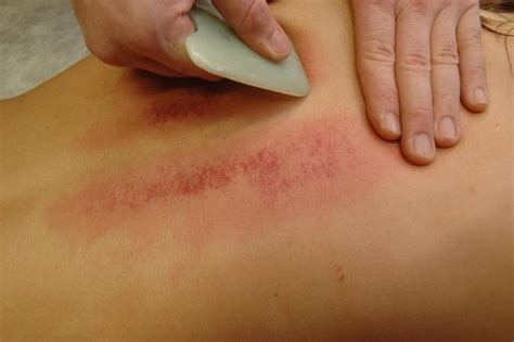 It's a treatment that involves scraping a flat jade or. GUA SHA AND ITS HISTORY | Body Balance