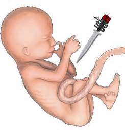 Reduce el peso de muchas imágenes gif a la vez online. Aborto gif » GIF Images Download