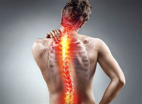 Imaging in Lower Back Pain | FORM + FUNCTION PHYSIOTHERAPY