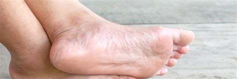 Czy stopy cukrzycowej można uniknąć? Wspomaganie leczenia stopy cukrzycowej - Help4skin