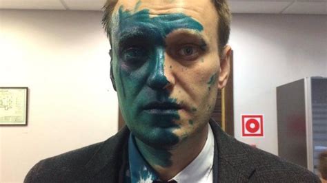 И замглавы этой онк владимир григорян уже обвинил алексея в симуляции. Навального в Москве неизвестные облили зеленкой: Появились ...
