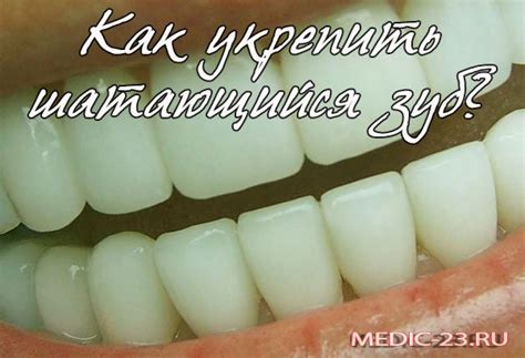 Ak tento problém neriešime, môžu sa dostaviť ďalšie bolesti. Шатается зуб: как укрепить медикаментозно и народными ...