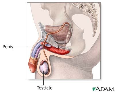 If the cancer has spread to lymph nodes or other parts of the body it may cause other symptoms. testicular cancer misdiagnosis lawyers medical malpractice ...