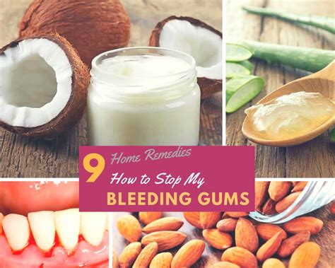 What causes bleeding from the roof of the mouth? Home Remedies to Stop Bleeding Gums & Gingivitis { 9 ...