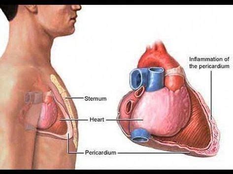 We did not find results for: mesothelioma pathology outlines #asbestos | Mesothelioma ...