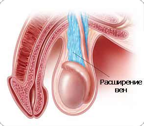 Causes, symptômes et traitements de la douleur aux testicules. Операция по удалению варикоцеле | Проблемы мужского и ...