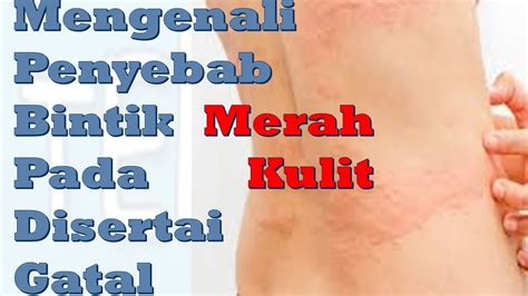 Infeksi jamur pada kulit tubuh (tinea korporis): Mengenali Penyebab Bintik Merah pada Kulit Disertai Gatal ...