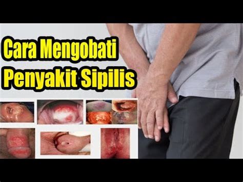 Nyeri selama hubungan seksual atu pada saat buang air kecil. Obat Penyakit KELAMIN PRIA Paling Ampuh Sipilis Raja Singa ...