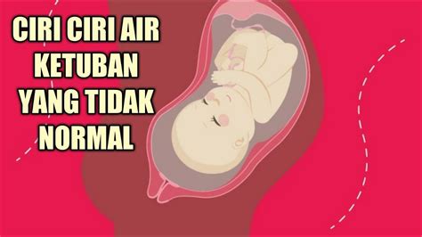 Air ketuban yang normal umumnya memiliki bau seperti air kelapa. Ciri Ciri Air Ketuban Tidak Normal yang Sering Terjadi ...