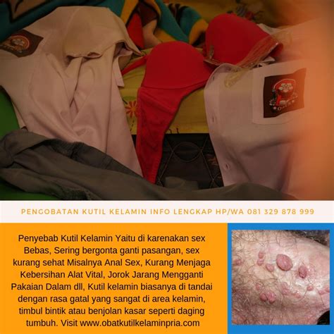 Pada kasus ini, kita akan membahas front tersebut serta dampaknya pada curah hujan dan cuaca lokal. Salap Genital Warts Ubat Untuk Ketuat Alat Kelamin Lelaki