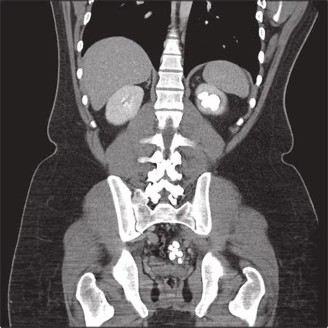 The time it takes a scan a property can vary greatly. How long does a ct scan for kidney stones take ...