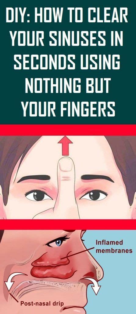 DIY: How To Clear Your Sinuses in Seconds Using Nothing ...