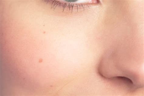 The medical term for this growth is trichiasis. How to Tame Wild Eyelashes | LEAFtv