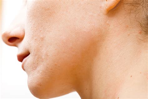 Maybe you would like to learn more about one of these? 5 Easy Ways to Remove Blemishes - PHLEARN