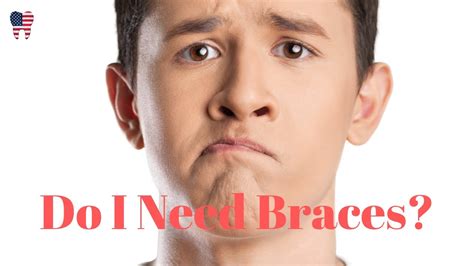 Why are you even asking this question. Do I Need Braces - Take the Quiz - YouTube