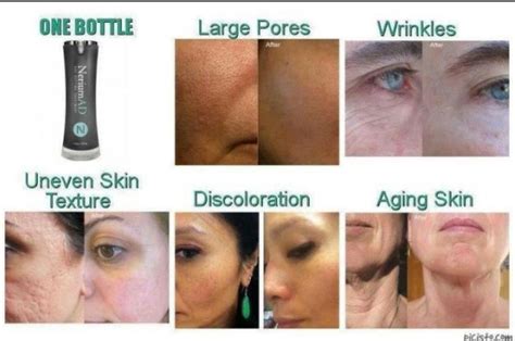 One of the most common issues you'll have to deal with when shootings portraits is uneven skin tones. One Bottle does it all!! Nerium one step; one bottle www ...