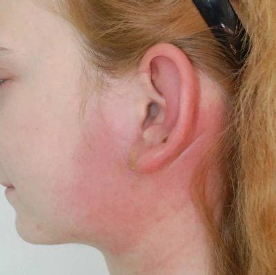 The effects of body piercing and puncture various parts of ...