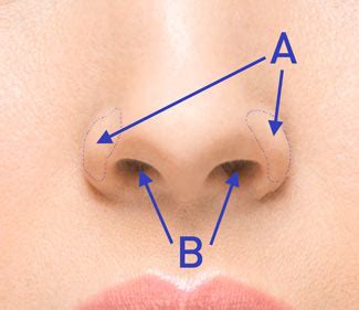 So part of the polyp is in the sinus and part in the nose and nasopharynx. single word requests - What's this part of the nose called ...