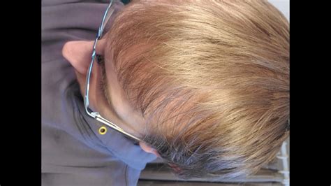 Unfortunately, most people today consume processed and gmo foods that provide you with just a fraction of a daily dose of niacin. RevivSerum Hair Growth Stimulant Review - YouTube