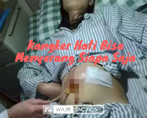 Kanker hati ialah dalah suatu kanker yang timbul dari hati. Bukan Karena Hamil Perut Wanita ini Membesar, Ternyata ...