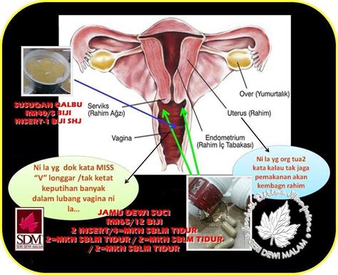 Mengecutkan dan mencuci rahim selepas bersalin. Seri Dewi Malam ~ Lynn Putrajaya: Cara insert Jamu Dewi ...