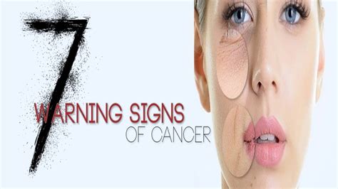 You can, however, pay attention to small changes in your. 7 Early Warning Signs of Cancer Most People Ignore - YouTube