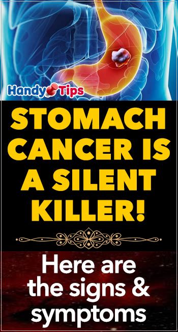 Mouth and throat cancers are cancers that originate on the lips, the roof, sides, or floor of the mouth, tongue, tonsils, or back of the throat. Gastric cancer early symptoms - Hpv virus and throat ...