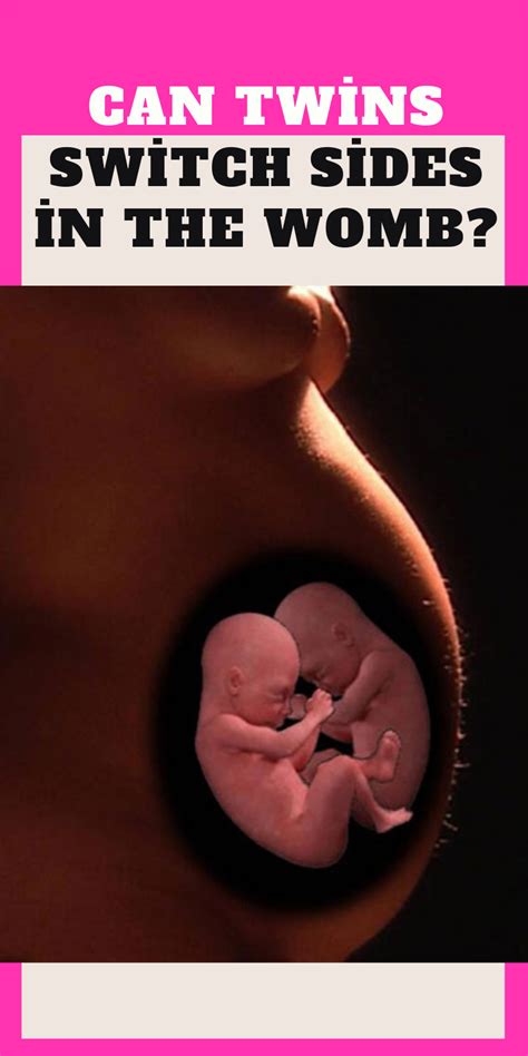 Otc painkillers combined with hot and cold packs and exercise can significantly reduce symptoms. Can Twins Switch Sides in the Womb? in 2020 | Twins, Womb ...