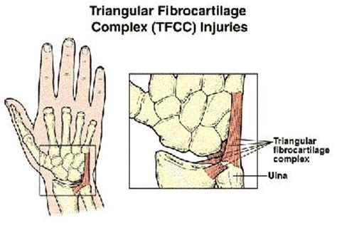 Lubiatowski p, romanowski l, spå‚awski r, manikowski w, ogrodowicz p. Injury Info