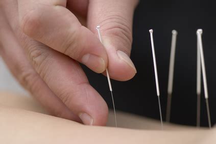 Devenir acupuncteur : comment devenir acupuncteur ...