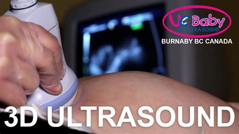 We did not find results for: UC BABY 3D ULTRASOUND - BURNABY BC - YouTube