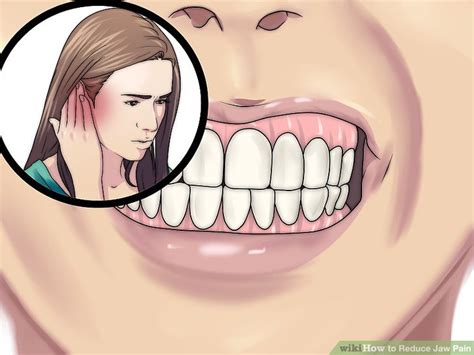 Search online for licensed massage therapists near you that you can visit. 4 Ways to Reduce Jaw Pain - wikiHow