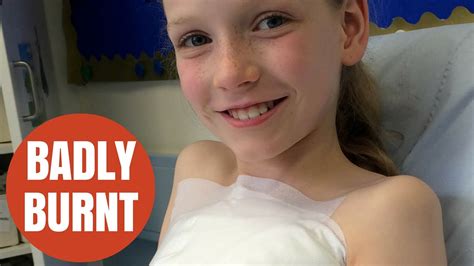 Thank you for submitting your comment! Nine-year-old girl suffers horrific burns filling up hot ...