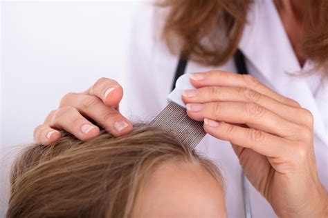 Jun 21, 2021 · how scalp microneedling can cause temporary hair shedding, and advantages of injection treatment. Medical News Today: How to tell the difference between ...