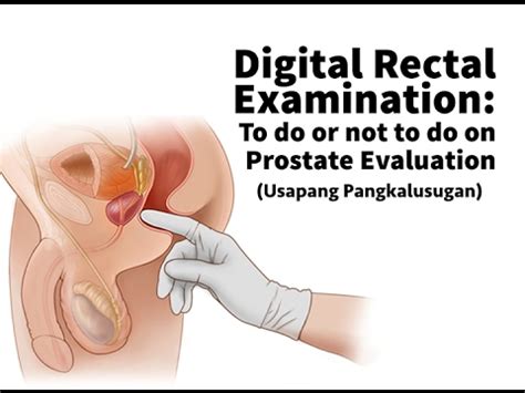 Palpatio per anum, ppa) is an internal examination of the rectum, performed by a healthcare provider. Digital Rectal Examination: To do or not to do on Prostate ...