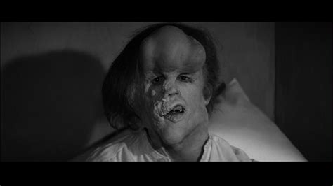 The film of the elephant man is not based on the successful stage play of the same name, but they both draw their sources from the life of john merrick, the original elephant man, whose rare disease imprisoned him in a cruelly misformed body. Filmfanatic Org Elephant Man The 1980