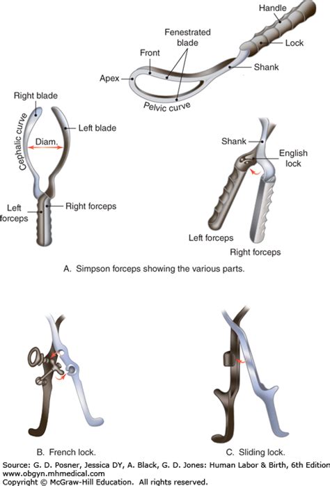 Present in kielland's and barton's forceps. Operative Vaginal Delivery | Oxorn-Foote Human Labor ...