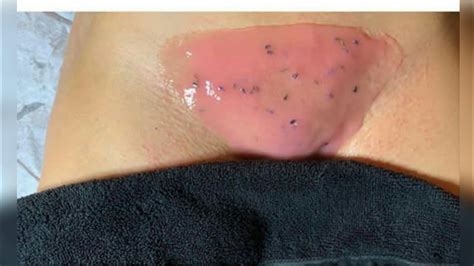 These brazilian wax are ideal for painless hair removal. Pink Brazilian wax|| Waxing - YouTube