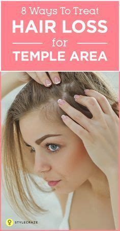 Preventing hair loss is as simple as eating food! 8 Simple Ways To Treat Hair Loss At The Temples | Temple ...