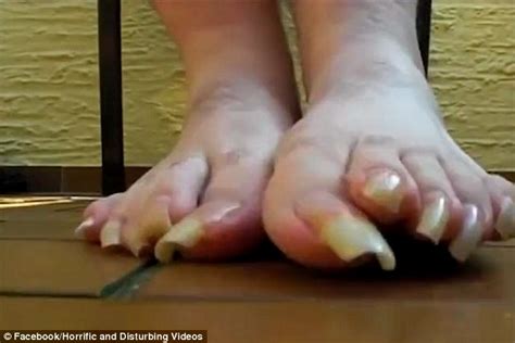 Ocuparse de tus uñas de los pies requiere recortarlas periódicamente para mantenerlas sanas. Pies Feos Uñas Largas : El ránking de las famosas con los ...