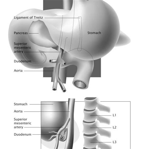 Understandably it is prone to may diseases. Preoperative anteroposterior radiograph of the spine shows ...