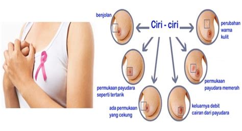 Bila saya bernafas atau baring payudara kanan sangat. Cara Menghilangkan Benjolan Di Payudara: 7 Jenis Penyakit ...