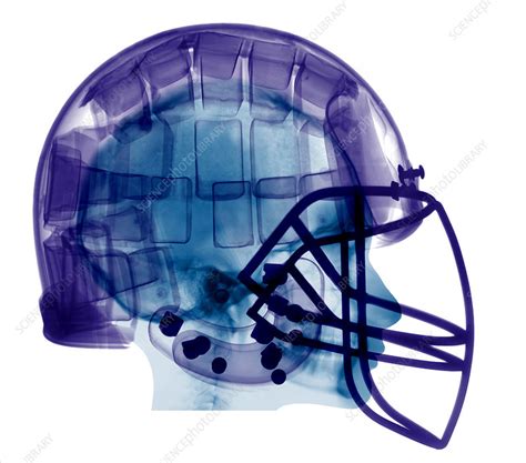 Bern snowboard helmet with goggles. Football Helmet, X-Ray - Stock Image - C004/8981 - Science ...