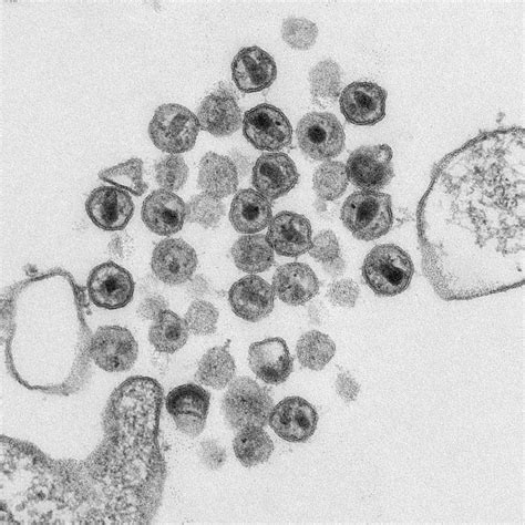 Electron microscopy was used to observe the isolated virus, hv114 and the variation of infected conclusions: חיידקים, נגיפים, ושאר "ירקות" - בלוג של ביולוג - ד"ר דרור ...