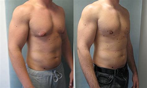 A marriage of convenience does not always work out perfectly. INDIVEDA 100% Pure Organic Men Breast Reducer Grade A ...